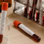 When Should You Get Blood Work Done?